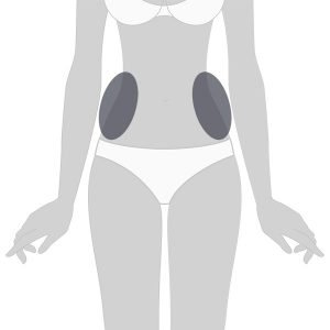 Velashape Flancos x 8